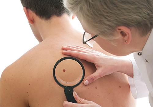 Skin Cancer Treatment Ogden Utah Allen Taintor Dermatology