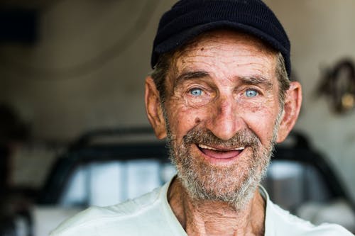 Age Spots Ogden UT Allen Taintor Dermatology