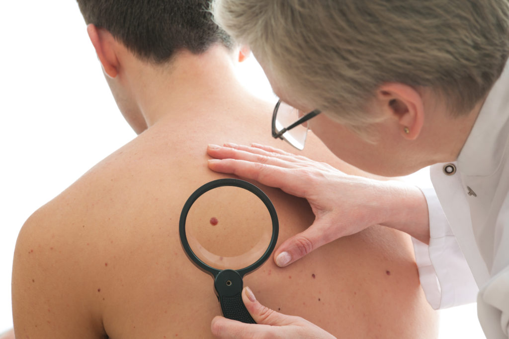 Skin Cancer Signs Allen Taintor Dermatology Ogden UT