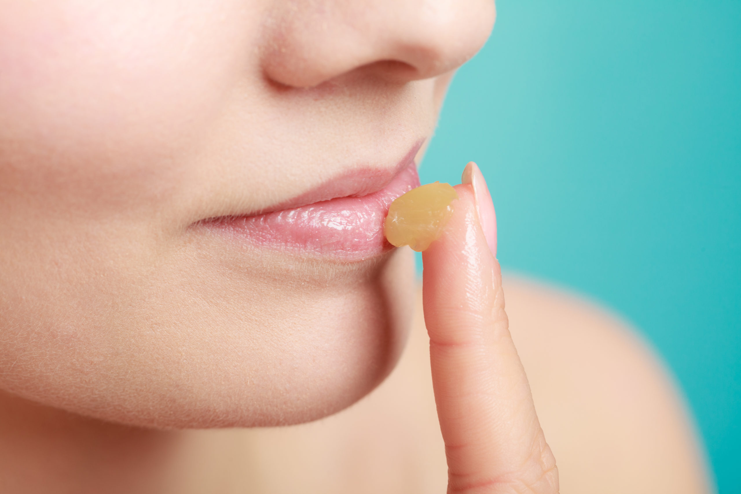 chapped lips Allen Taintor Dermatology