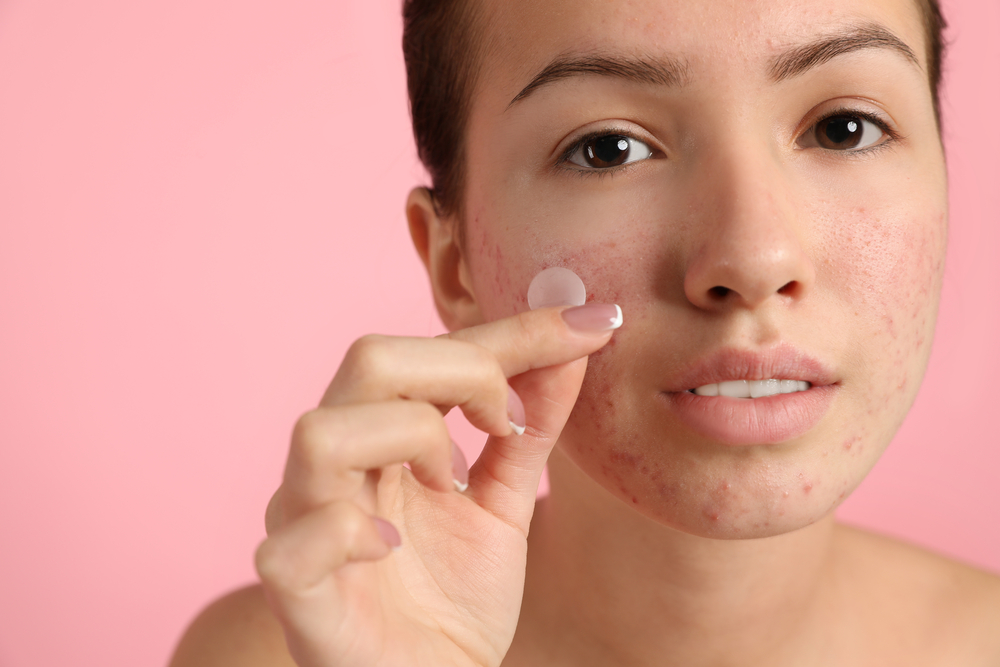 popping pimples is bad for your skin