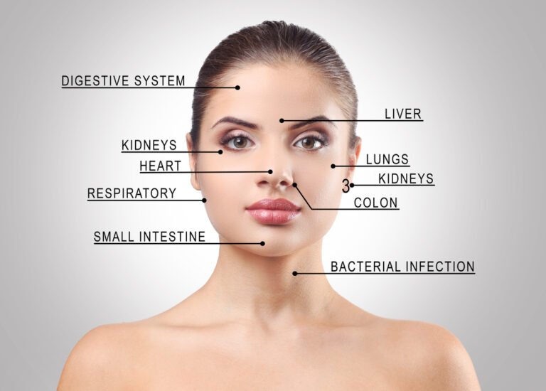 Is The Acne Face Map Legit? Important Facts You Need To Know